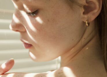 Pigmentation explained: Why there is no single solution to uneven skin tone
